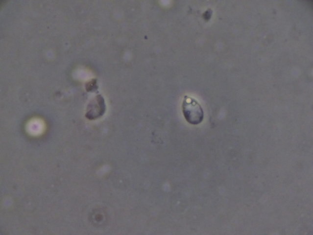Botryobasidium con spore finemente verrucose